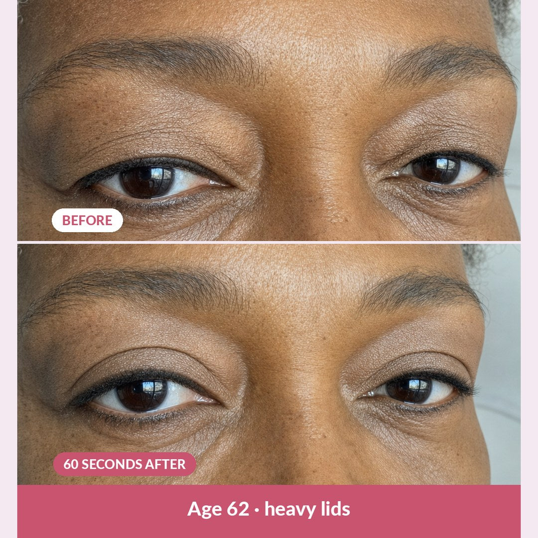 Before and 60 seconds after, age 62