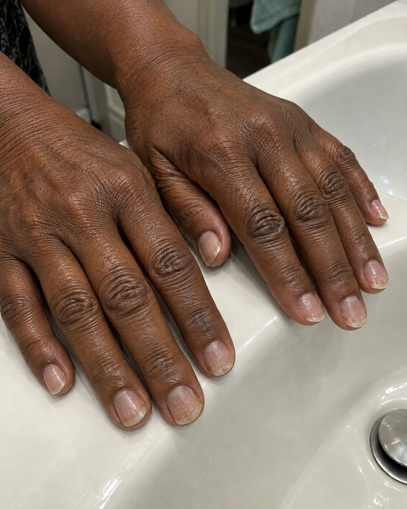 Thin peeling nails after gel
