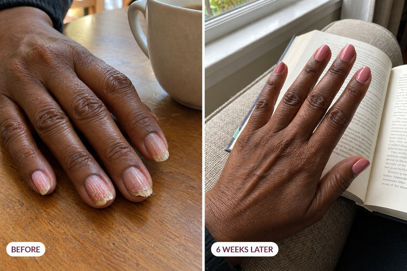 Customer nails before and six weeks later