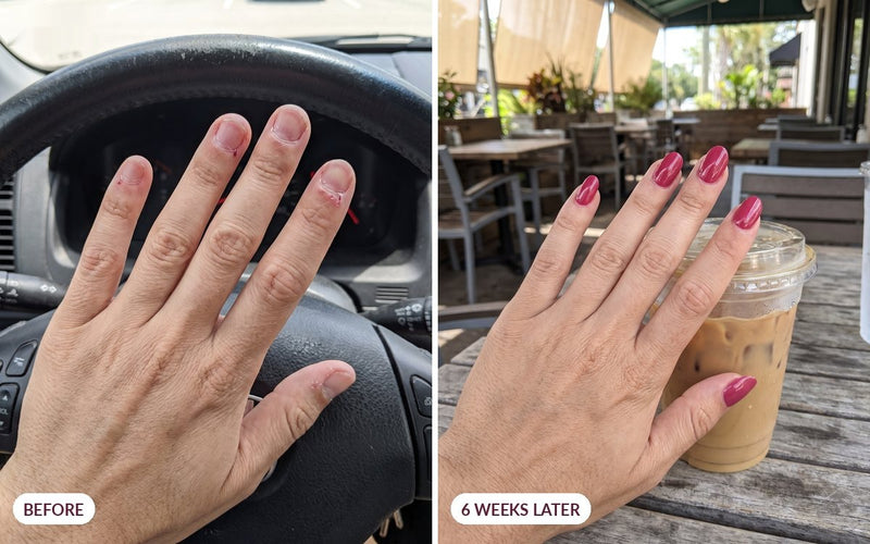 Customer nails before and six weeks later