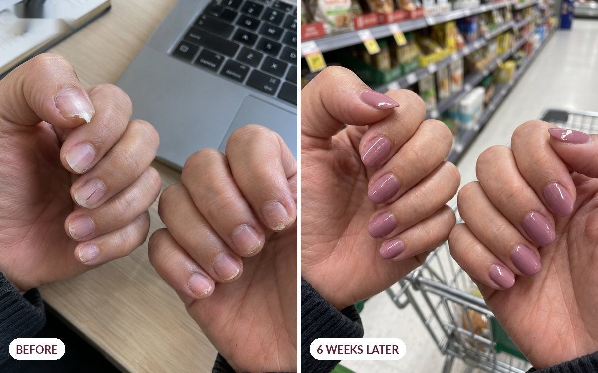 Before and six weeks later