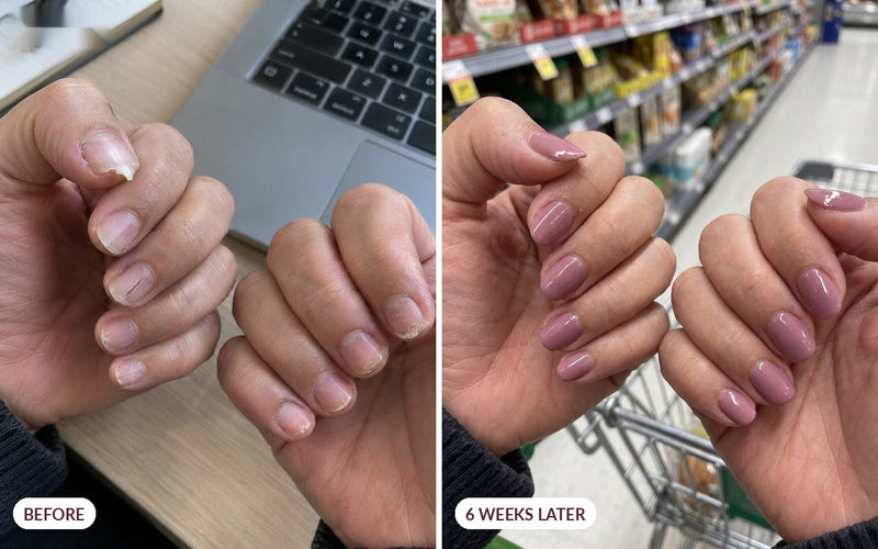 Customer nails before and six weeks later