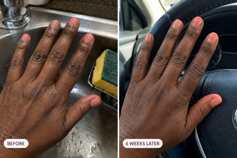 Customer nails before and six weeks later