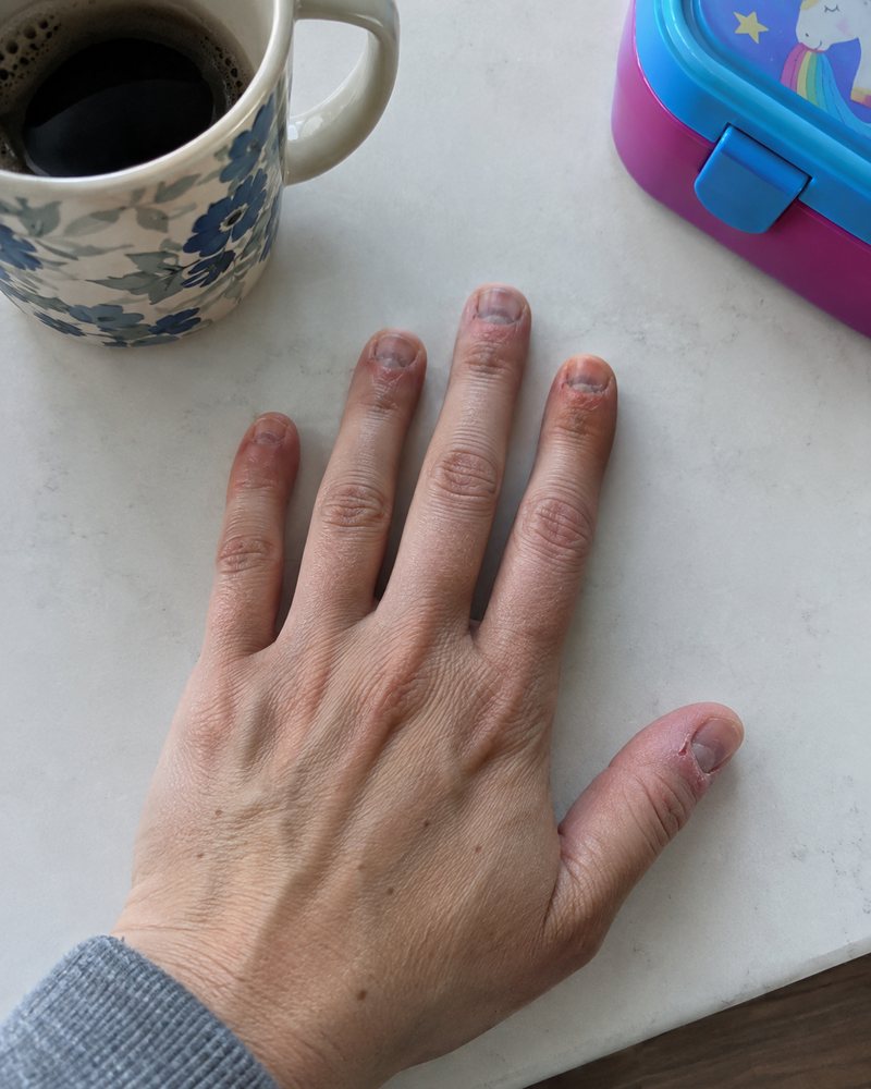 Bitten, broken, cut short