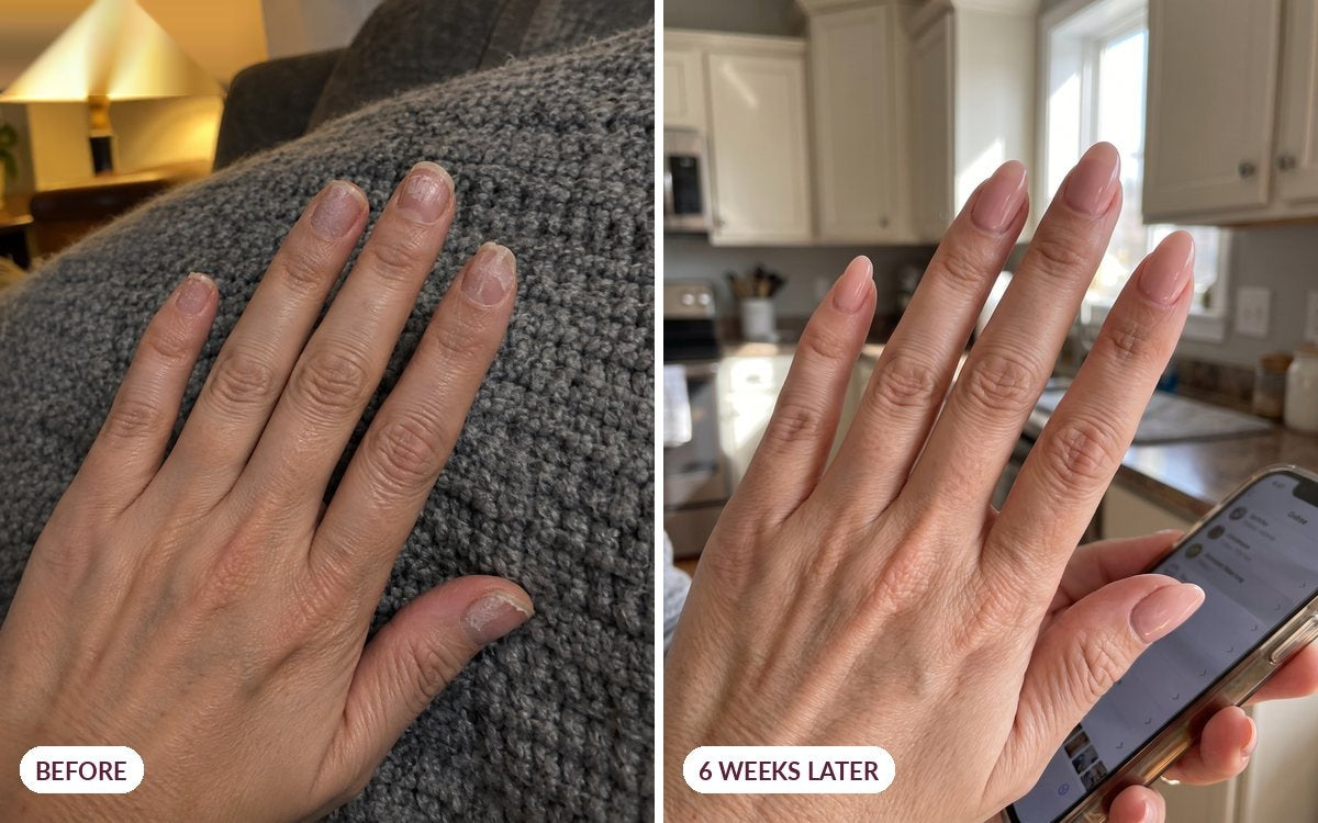 Before and six weeks later