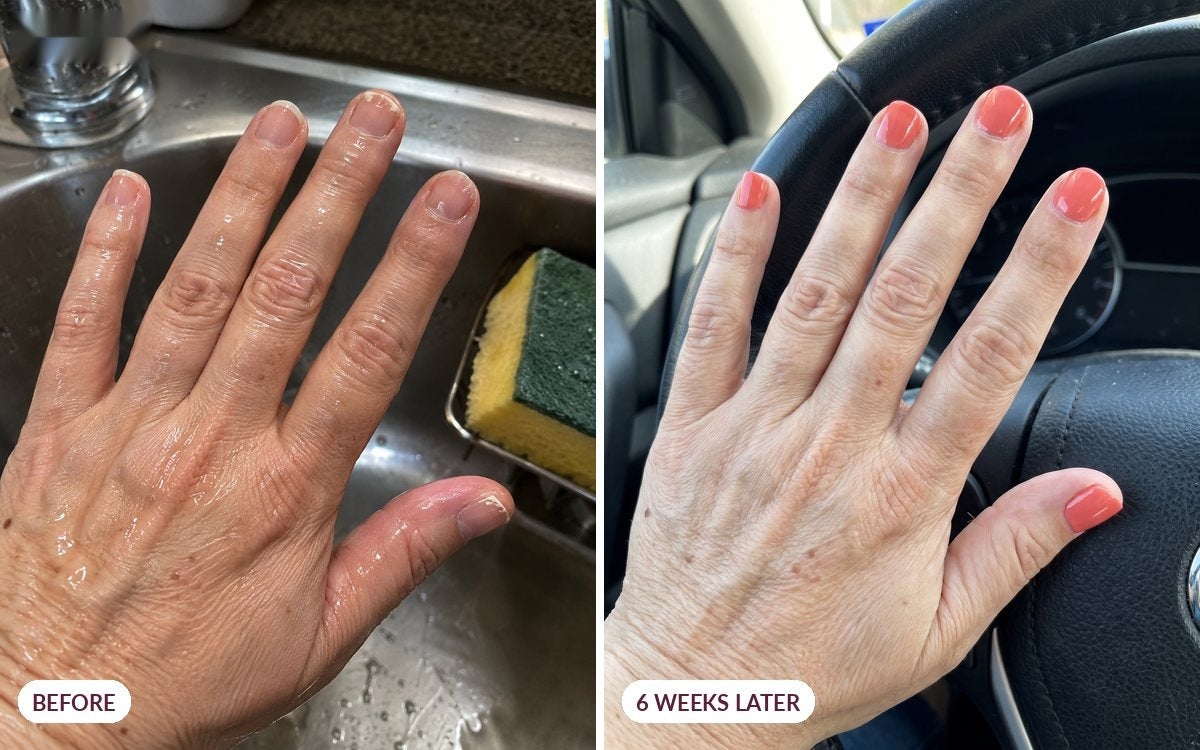 Before and six weeks later