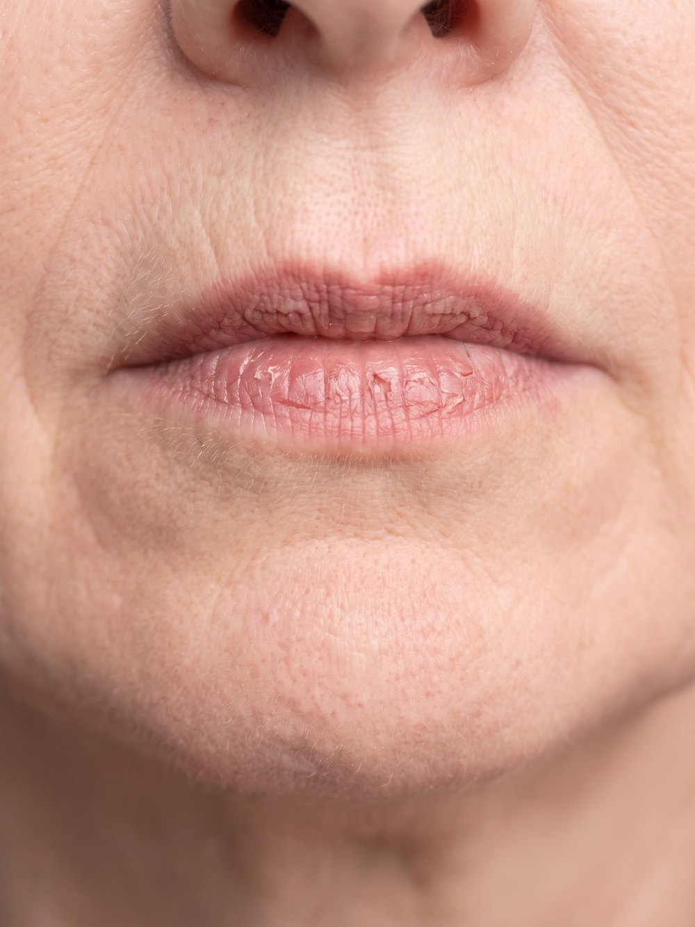 Classic lipstick on thin cracked lips